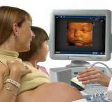 SAD 3D tijekom trudnoće