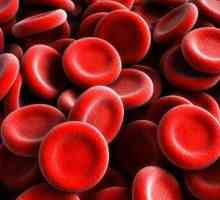 U kojim slučajevima treba uzeti u obzir Rh faktor? Trudnoća i transfuzija krvi
