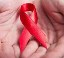 Vjerojatnost HIV infekcije s jednim nezaštićenim kontaktom. Prevencija infekcije HIV-om