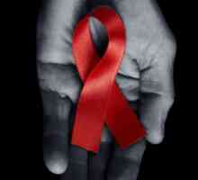 HIV - koliko je opasno ovaj virus? AIDS utječe na koje stanice? Prevencija AIDS-a