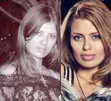 Victoria Bonya prije i poslije lip plastića