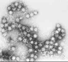 Coxsackie virus: razdoblje inkubacije, simptomi, liječenje, posljedice