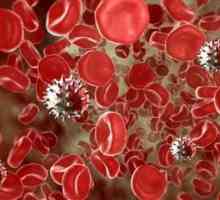 Virus varicella-zoster - što je to? Herpes zoster: liječenje, uzroci, simptomi