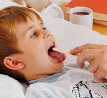 Virusni bol u grlu u djetetu: liječenje, komplikacije, fotografija