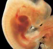 Intrauterni razvoj djeteta: razdoblja i faze s fotografijom. Intrauterin razvoj djeteta po mjesecu