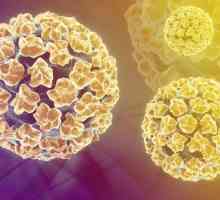 HPV 16 i 18 vrsta: uzroci, dijagnoza, simptomi i liječenje. Humani papiloma virus (HPV) onkogenog…