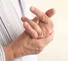 Dislokacija prsta na ruci: opis i značajke liječenja