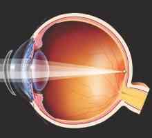 Zamjena leće oka: operacija, rehabilitacija, recenzije
