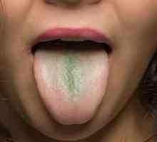 Zelena ploča na jeziku: uzroci pojave i liječenja