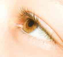 Žute oči kod ljudi: uzroci simptoma žutih očiju