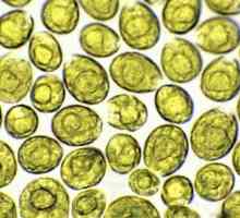 Zlatna alge: vrsta i imena