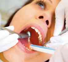 Mudrost zuba liječiti ili ukloniti? Ekstrakcija zuba mudrosti