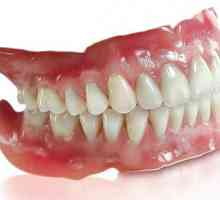 Dentalna proteza `Sandwich`: značajke, prednosti i recenzije