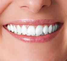 Dentalni implantati: pro i kontra. Dentalni implantati: cijena, recenzije