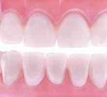 Zubne mekane proteze: stručne recenzije, fotografije