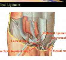 Što je žuti ligament kralježnice i kako se taj tkivo manifestira hipertrofijom