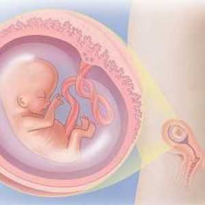 Pobačaj na 10. tjednu trudnoće: gdje treba učiniti, posljedice