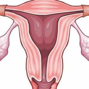 Adenomyoza maternice: znakovi i liječenje, recenzije