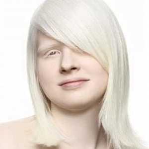 Albinovi su ... Albinizam je kongenitalan odsutnost pigmenata melanina