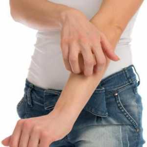Alergije na nogama i rukama: uzroci, simptomi i karakteristike liječenja