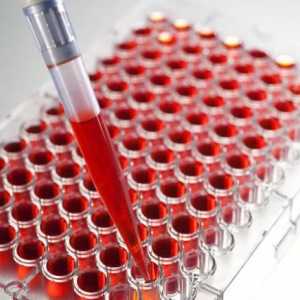 Krvni test za tuberkulozu: značajke, vrste i transkripcija