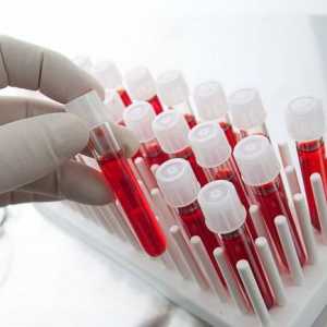 Krvni test za rak. Je li moguće odrediti rak krvnim testom?