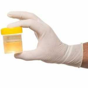 Analiza urina Nechiporenko. Kako ga pravilno montirati?