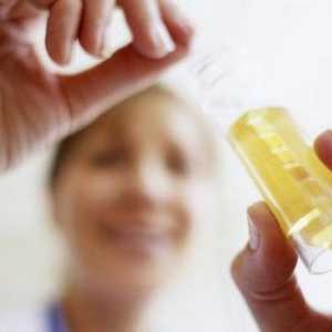 Analiza urina za cistitis: što treba poduzeti, kako se pripremiti, dešifrirati
