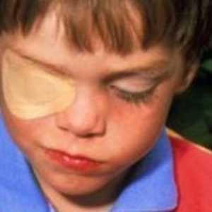 Hardversko liječenje očiju kod djece: opis postupka, učinkovitost i povratne informacije