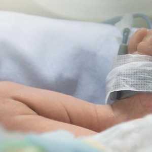 Asfiksija novorođenčadi: težina, uzroci, liječenje, posljedice
