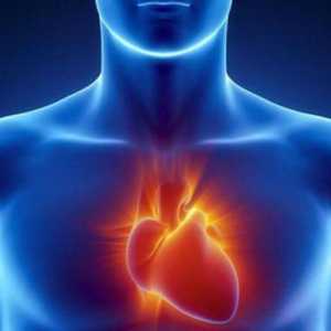 Asistola srca - što je to? Simptomi, uzroci, hitan tretman, liječenje