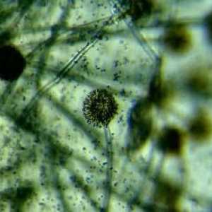 Bakterije i mikrobi pod mikroskopom (fotografija)