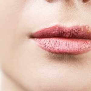 Bijele točkice na usnama pod kožu: pogledajte kako postupati