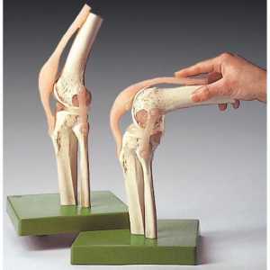 Bol u koljenu s vanjske strane: liječenje, uzroci