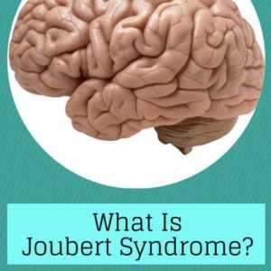 Bolest na razini genetike - Joubertov sindrom