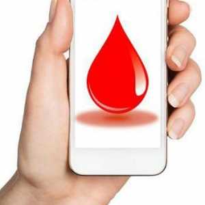 Je li bolno donirati krv iz žile na donaciju?