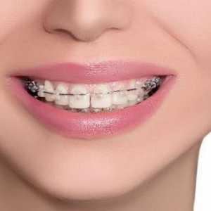 Je li bolno staviti proteze na zube? Opis postupka