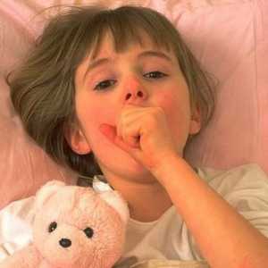 Bronhitis kod djeteta - što liječiti i kako?