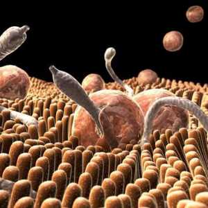Crvi u ljudskom tijelu: znakovi i izvori infekcije
