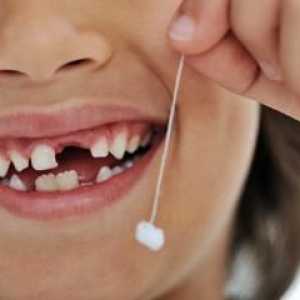 Što učiniti kada dječji zubi ispadnu