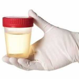 Što pokazuju analize urina za Nechiporenko? Da bi dešifrirala urinalizu Nechiporenko. Kako uzeti…