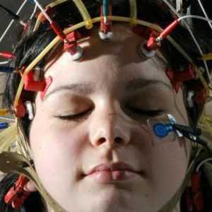 Što pokazuje elektroencefalogram mozga? Postupak, opis, svrha i povratne informacije