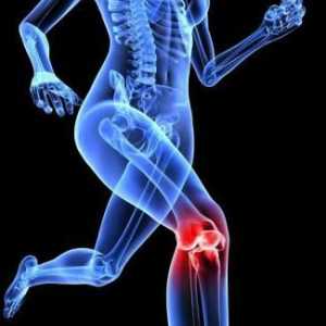Što je deformirana artroza koljena?