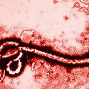 Što je Ebola i kako je virus prenesen ljudima?