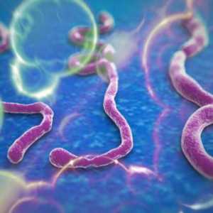 Što je Ebola? Ebola groznica: uzroci, simptomi, učinci
