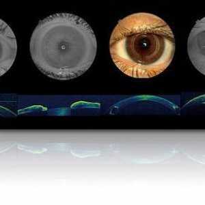 Što je optička koherentna tomografija oka?