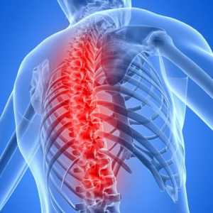 Što je osteochondrosis i kako se liječiti? Osteokondroza lumbalne regije. Uzroci osteohondroze
