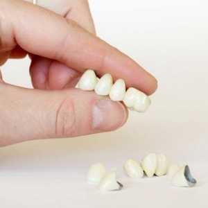 Što je zubna protetika? Vrste protetike