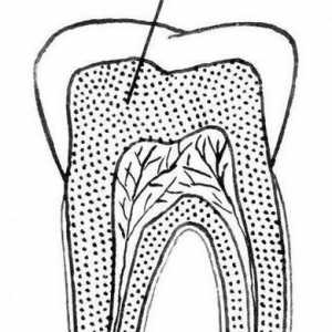 Dentin - što je ovo? Vrste, struktura, sastav i osobine liječenja