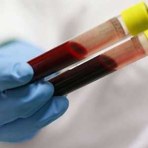 Dijagnoza bolesti. Biokemijski test krvi: što će to pokazati?